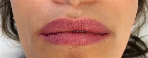 Portfolio Lip Blush Before And After Sian Dellar