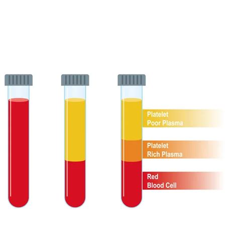 Estructura De La Sangre En Los Tubos De Ensayo Plasma Rico En