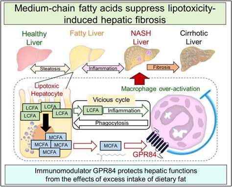 Jci Insight Medium Chain Fatty Acids Suppress Lipotoxicity Induced