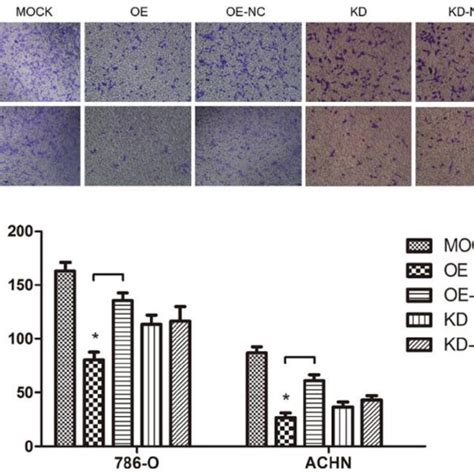 Tpm1 Up Regulation Inhibits Cell Motility In 786 O And Achn Cell Lines