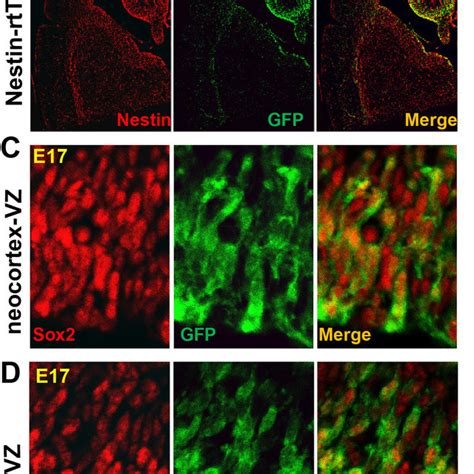 A Novel Model For Dissecting The Neural And Developmental Basis Of