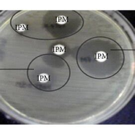 Phenotypic Detection Of Metallo Beta Lactamases By Combined Disk Test