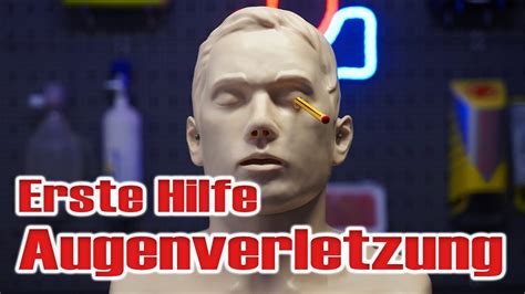 Erste Hilfe für Augen So versorgst du Augenverletzungen richtig