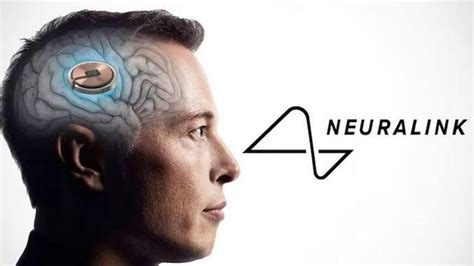 Neuralink Installato Il Primo Chip Di Elon Musk Nel Cervello Di Un