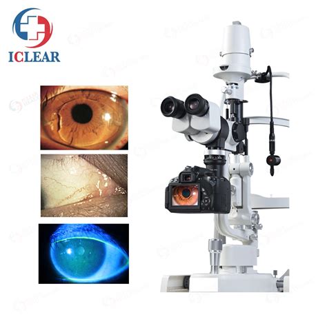 Classic Galilean Type Ophthalmic Digital Slit Lamp Microscope Slit