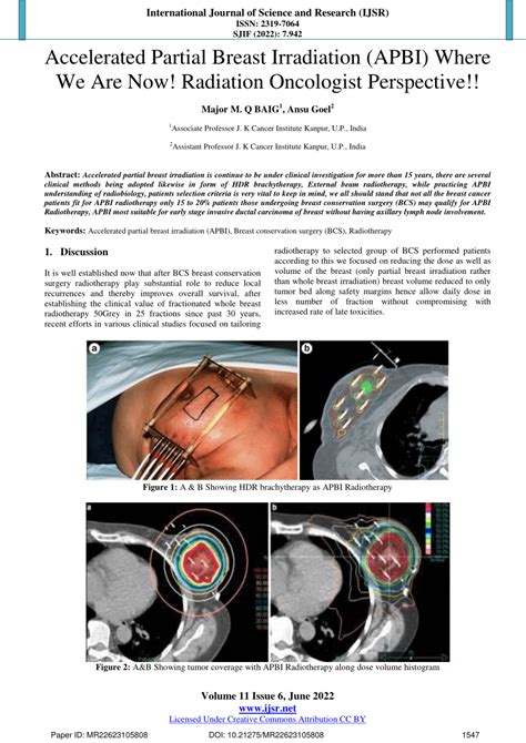 Pdf Licensed Under Creative Accelerated Partial Breast Irradiation