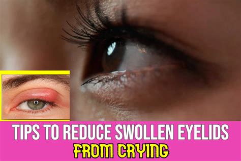 Tips To Reduce Eyelids Swelling Or Inflammation From Crying