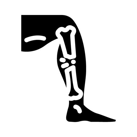 broken leg fracture injury glyph icon illustration 60184406 Vector Art