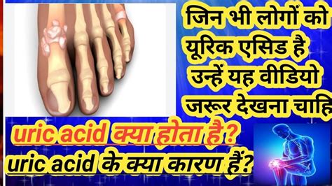 Uric Acid क्या होता है L Uric Acid Kya Hota Hai L Joint Pain L Gout L Uric Acid Joint Pain L Dr