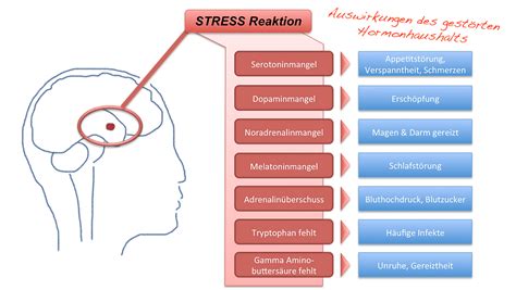 Stress Und Mentale Gesundheit Am Arbeitsplatz Immer Noch Ein Tabu