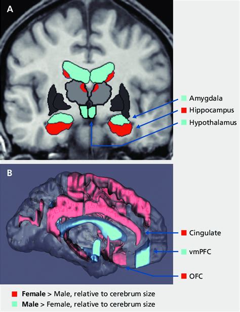 Sexually Dimorphic Subcortical A And Cortical B Regions In Stress