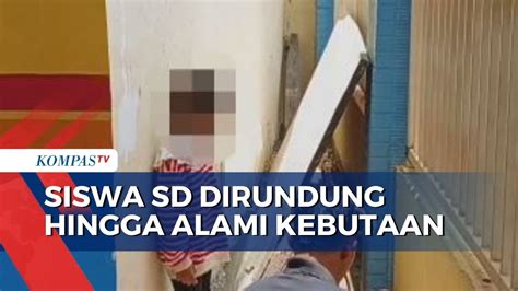 Miris Murid SD Alami Kebutaan Mata Kanan Diduga Akibat Dirundung