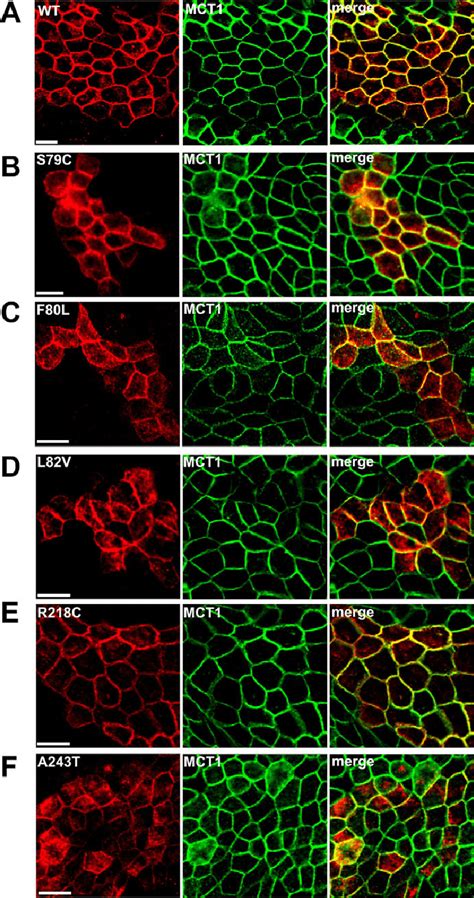 Colocalization Of Bestrophin 1 Mutants With The Plasma Membrane Marker