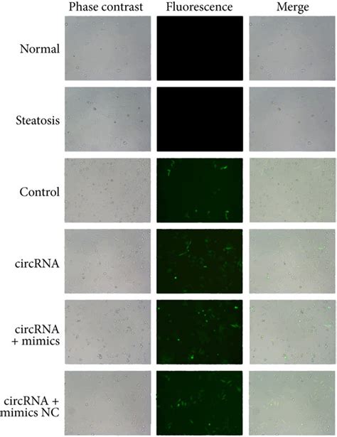 CircRNA 0046367 Exerts Antagonizing Effect On MiR 34a A Intersection