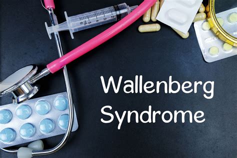 What is Wallenberg Syndrome? - Facty Health