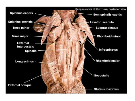 Splenius Capitis Muscle Cadaver