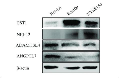 Different Expression Levels Of Cst Nell Adamtsl And Angptl