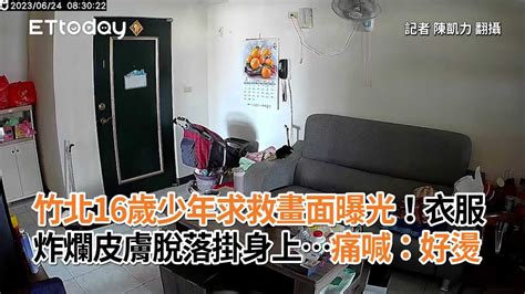 竹北16歲少年求救畫面曝光！衣服炸爛皮膚脫落掛身上痛喊：好燙 Youtube