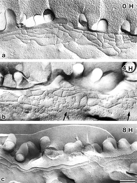 Freeze Fracture Replica Images Of Tjs In Mdck I Cells Incubated With