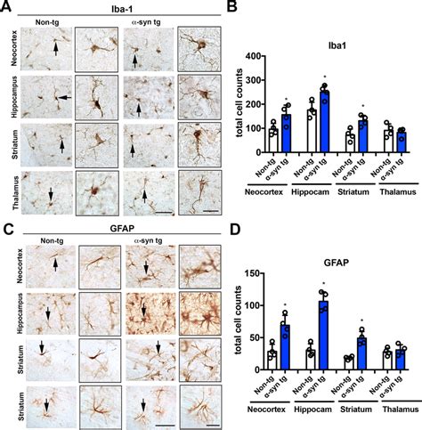 Immunohistochemical Analysis Of Microglial Cells And Astrocytes In The