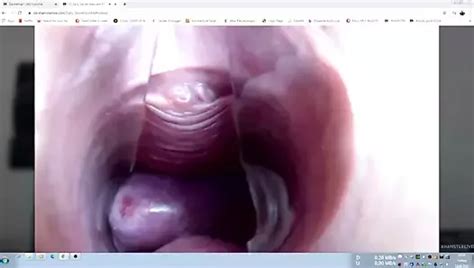 Free Cervix Porn Videos XHamster
