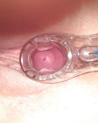 Cervix Porn Pics PICTOA