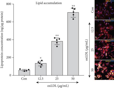 Oxidized Low Density Lipoprotein Oxldl Induced Lipid Accumulation