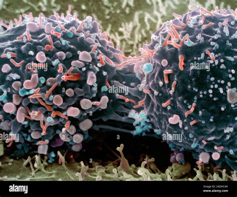 Cancer cell division. Coloured scanning electron micrograph (SEM) of a ...