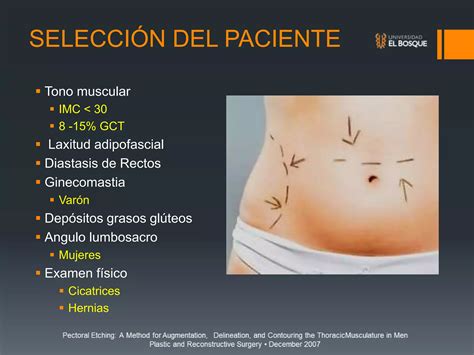 Lipoescultura De Alta Definici N Marcaci N Adbominal Ppt