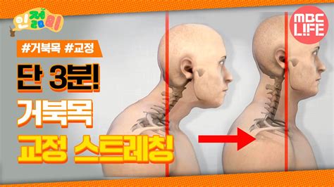 거북목 버섯증후군 라운드 숄더 있다면 이 운동 하셔야 합니다 하루 단 3분 거북목 교정 스트레칭 인젊미mbclife