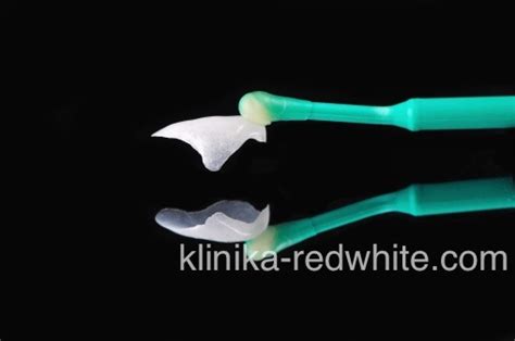 Люминиры на зубы в Твери – цены от 19000 ₽ в стоматологии «RedWhite»