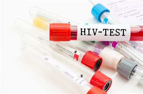 10 Early Warning Signs Of Hiv That You Must Know