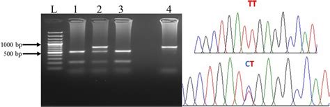 Photograph Showing Genotype Of VDR Apai Rs7975232 By PcR RFlP On