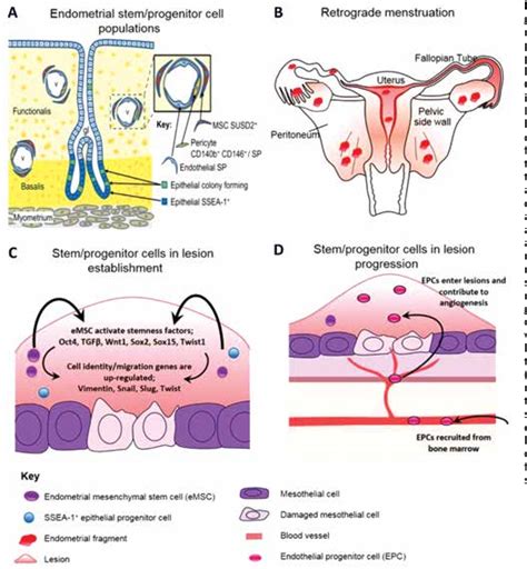 Figure 1 From Adult Stem Cells In The Pathogenesis And Treatment Of