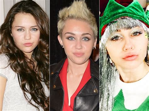 Miley Cyrus Lip Injections Plastic Surgery Before And After Photos