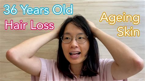 Hair Loss Recovery Journey Youtube