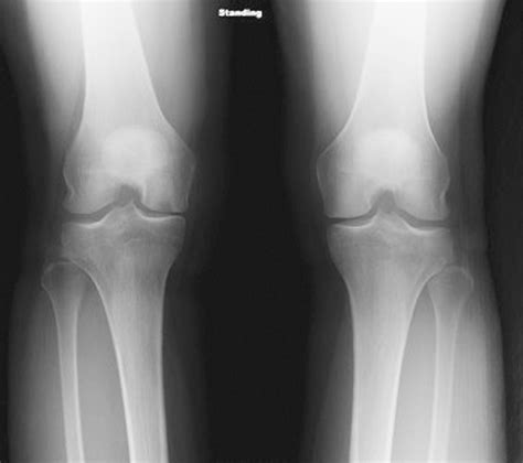 Figure 1 From The Diagnosis And Management Of Spontaneous And Post