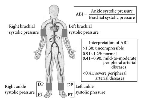 Peripheral Arterial Disease Medical Junction