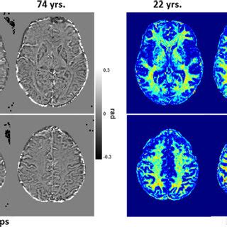 Swi Phase And Mwf Maps Derived From The Brains Of Three Men