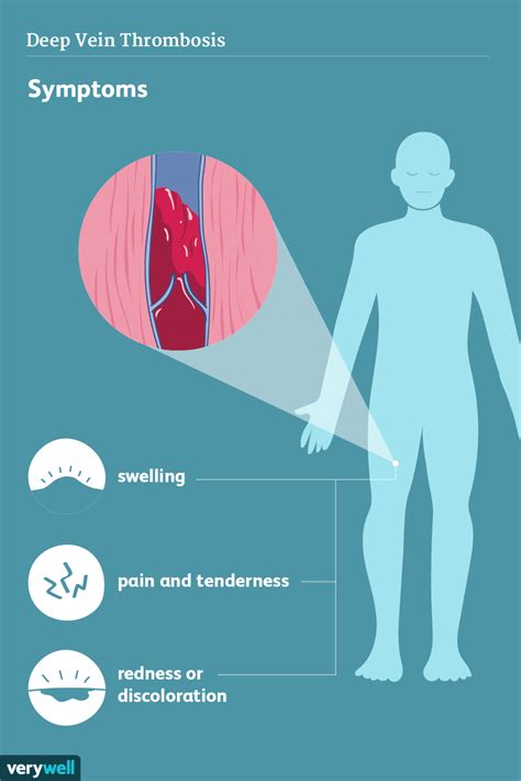 Signs, Symptoms, and Complications of Deep Vein Thrombosis