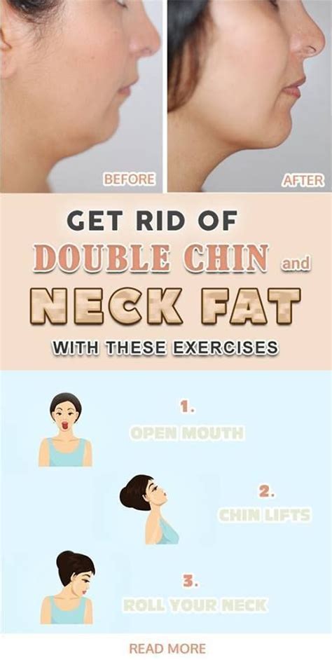 Pin On How To Lose Face Fat Fast