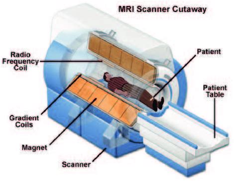 Mri Scan Diagram Hot Sex Picture