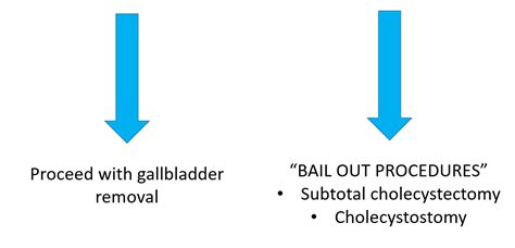 How To Perform A Safe Cholecystectomy Dr Magnus Jayaraj