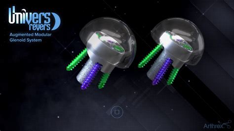 Arthrex Univers Revers Augmented Modular Glenoid System