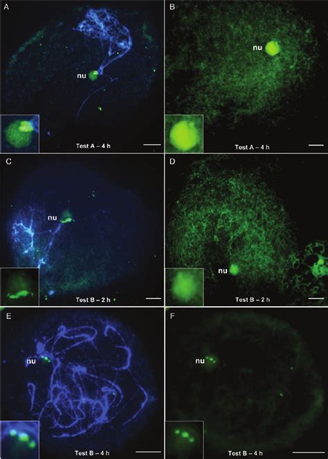 Fluorescence In Situ Hybridization Mapping Of The Rdna S Sequence