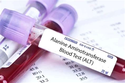 Alanine Transaminase (ALT): Potential Sources of Error in your Lab ...