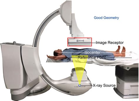 Good geometry has the vessel at isocenter which statistically has been... | Download Scientific ...