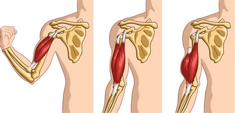What Causes a Bicep to Tear: How to Prevent and Treatment Options - POP