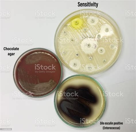 Antimicrobial Susceptibility Testing In Culture Plate Drug Sensitivity