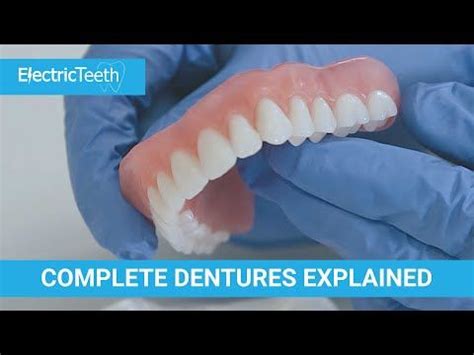 Complete dentures false teeth explained – Artofit